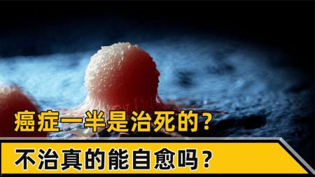 癌症真的是治死的吗？不治会怎样？揭秘年轻人得癌症的罪魁祸首！