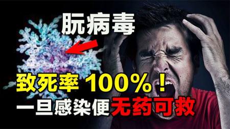 致死率100%！一旦感染了便无药可救，朊病毒到底有多可怕？