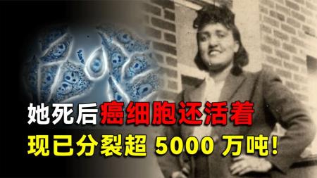 黑人妇女死后，癌细胞还活着，至今已分裂5000万吨！分布世界各地